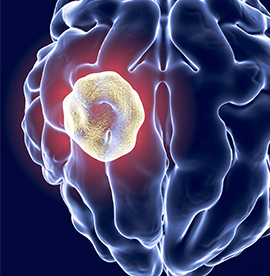 Colorectal cancer screening 